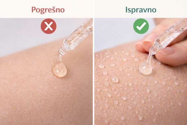 hijaluronska kiselina za lice upotreba