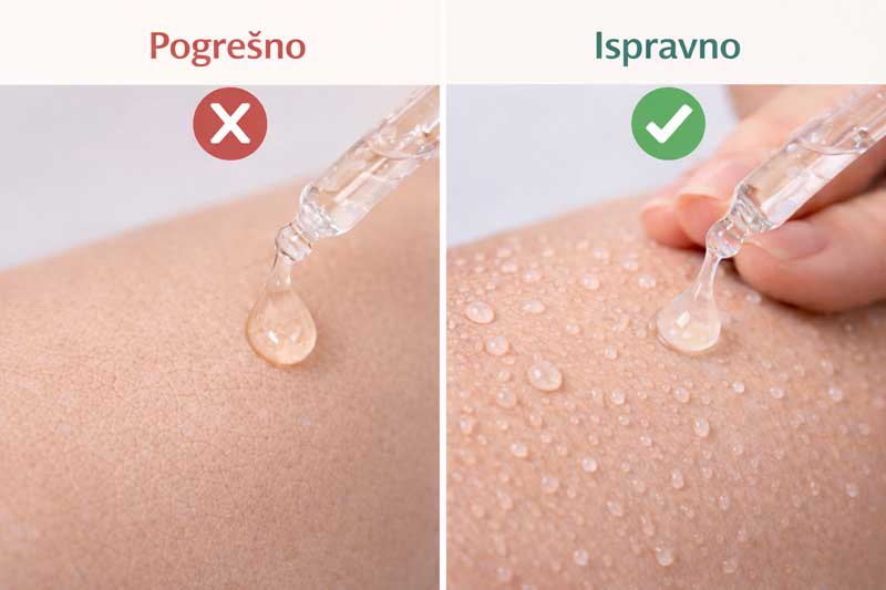 hijaluronska kiselina za lice upotreba