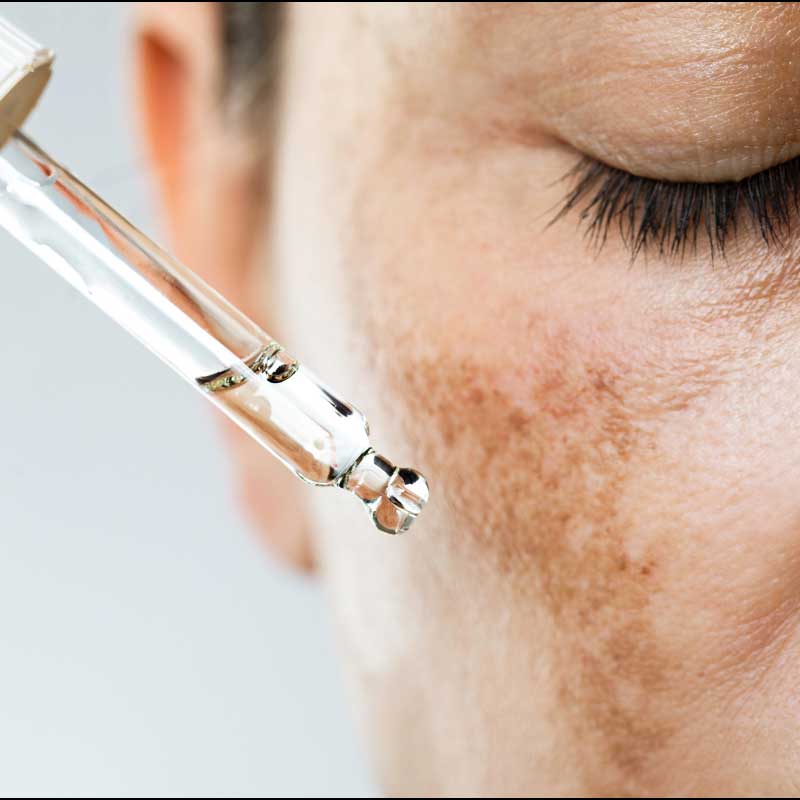 serum protiv fleka na licu ► Herbalia serum protiv fleka na licu